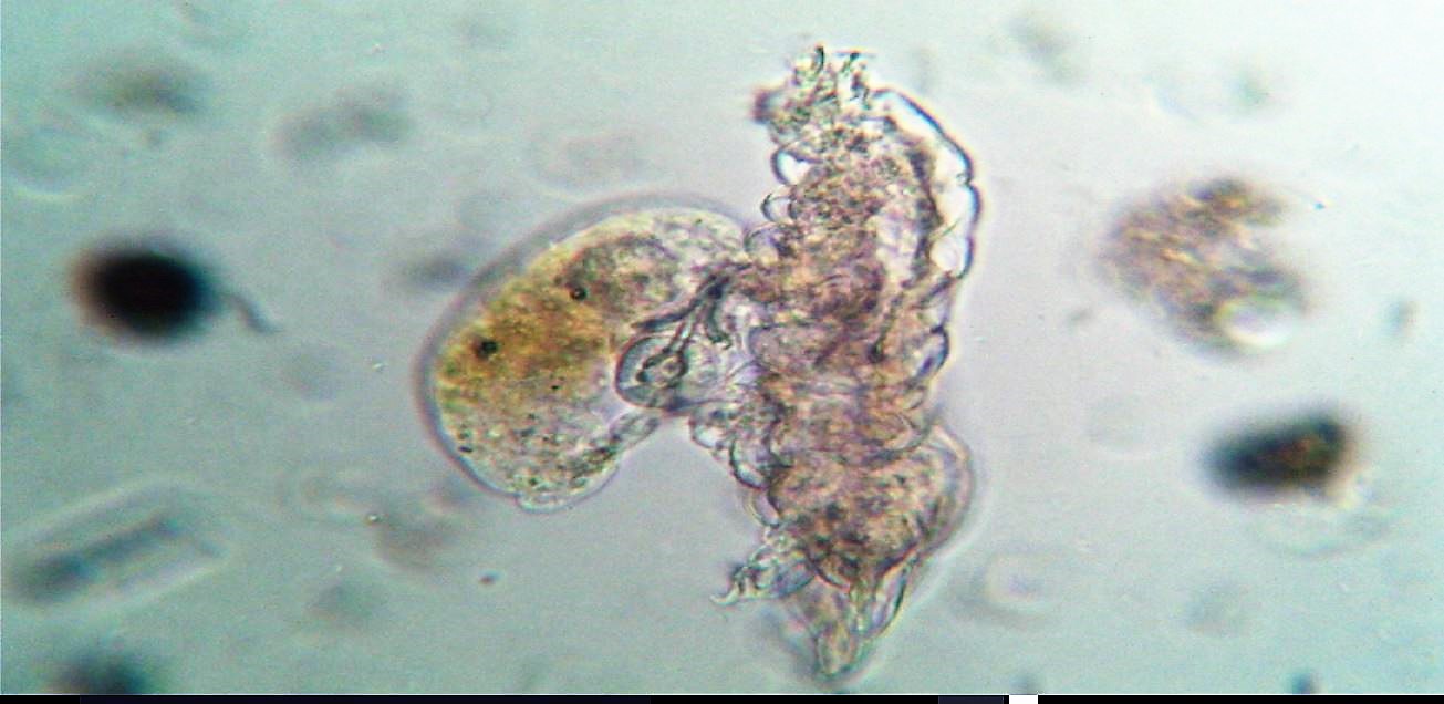 una, ritengo ,rarit al microscopio:Tardigrado morto e ciliato banchetta